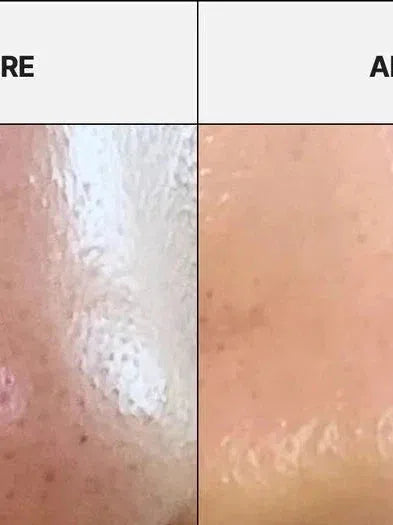 APRILSKIN Carrotene IPMP™ Hydromelt Cleansing Balm - Song of Skin