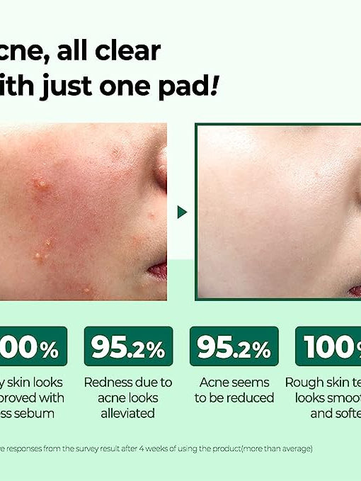 SOME BY MI AHA, BHA, PHA 30 Days Miracle Truecica Clear Pad
