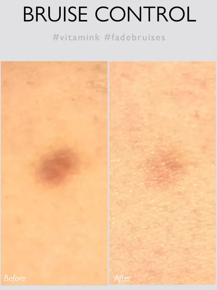 **SALE** Genabelle BLUECALM Rescue Gel