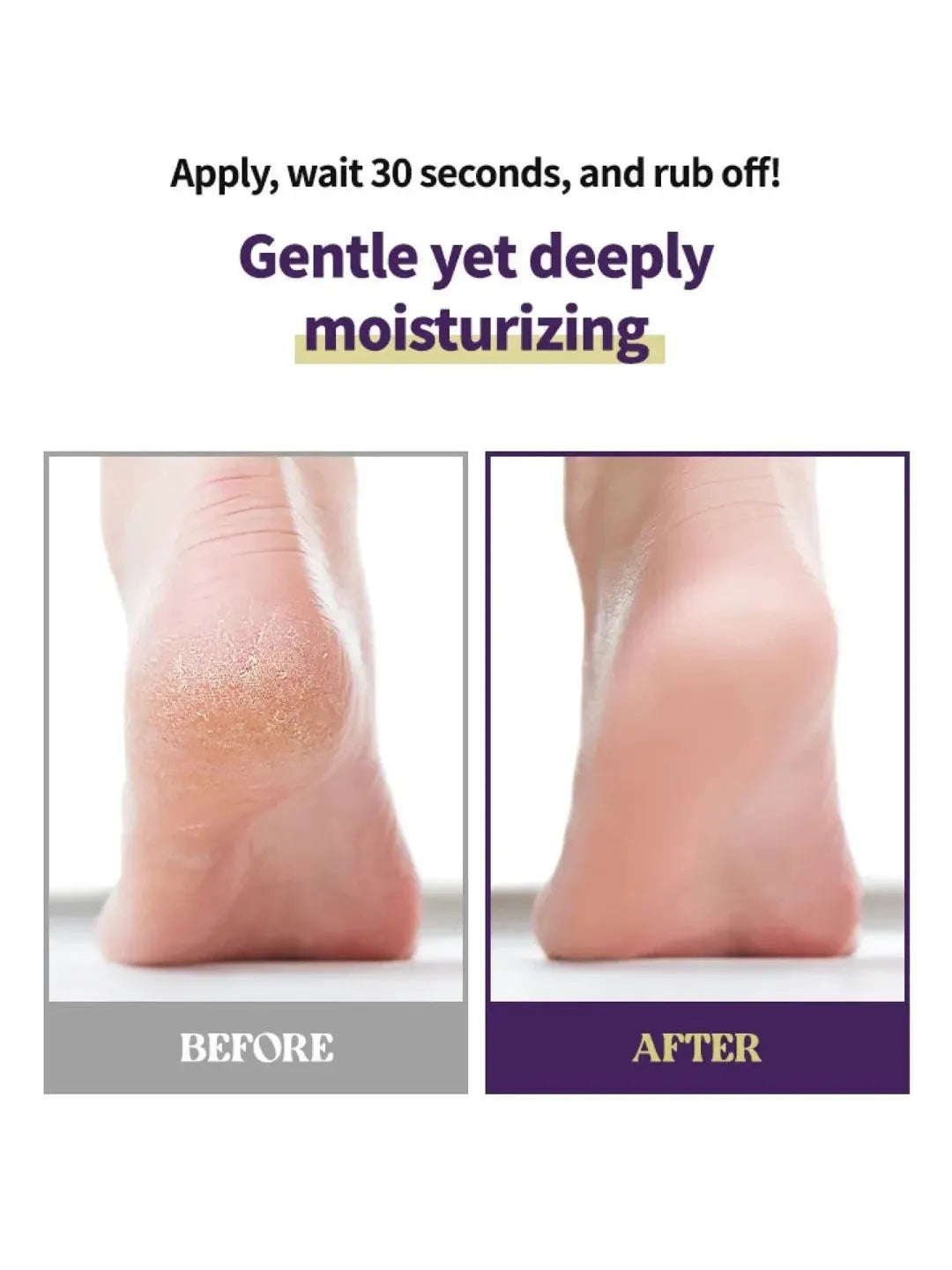 JULIOLY Foot Callus Remover Home Care Set - Song of Skin