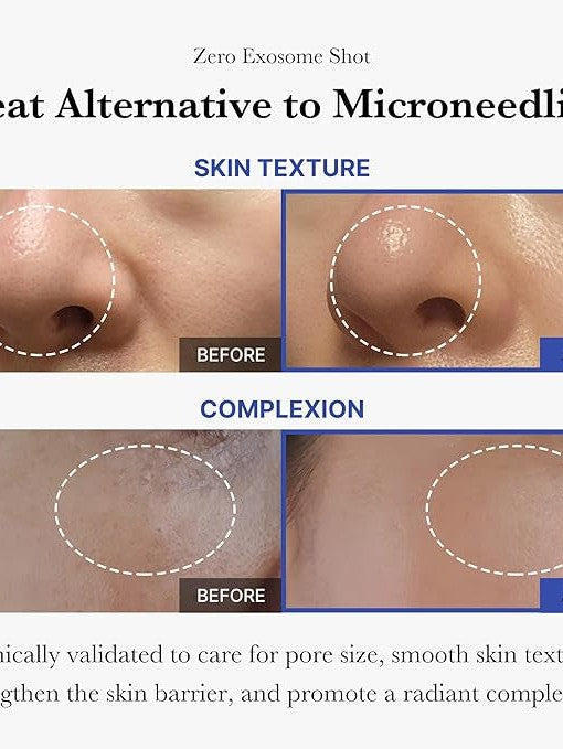 Medicube One Day Exosome Shot Pore Ampoule 2000 - Song of Skin