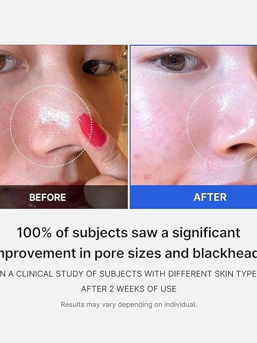 Medicube Zero Pore Pads 2.0 - Song of Skin