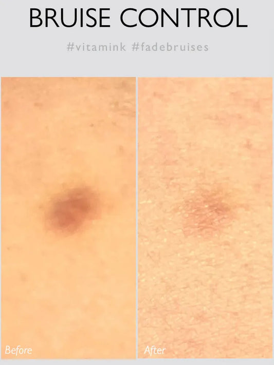 **BLACK FRIDAY DEAL** Genabelle BLUECALM Rescue Gel - Song of Skin