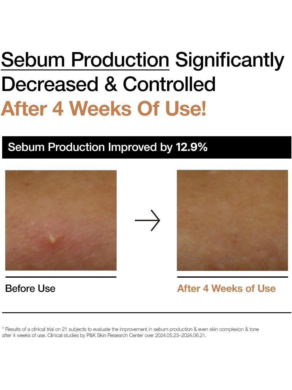 ANUA Rice 70 Glow Milky Toner - Song of Skin