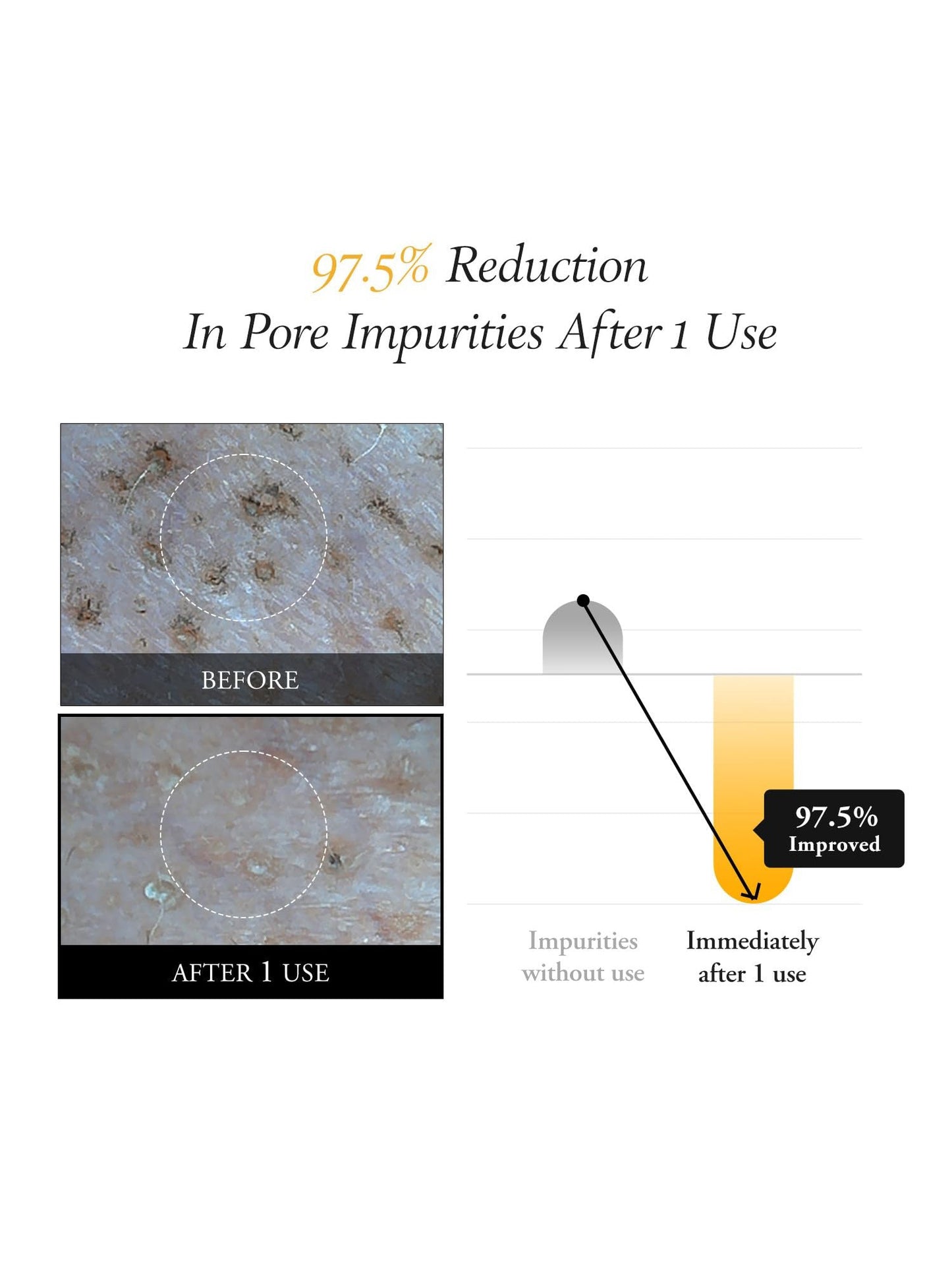 APRILSKIN Real Calendula Peel Off Pack - Song of Skin