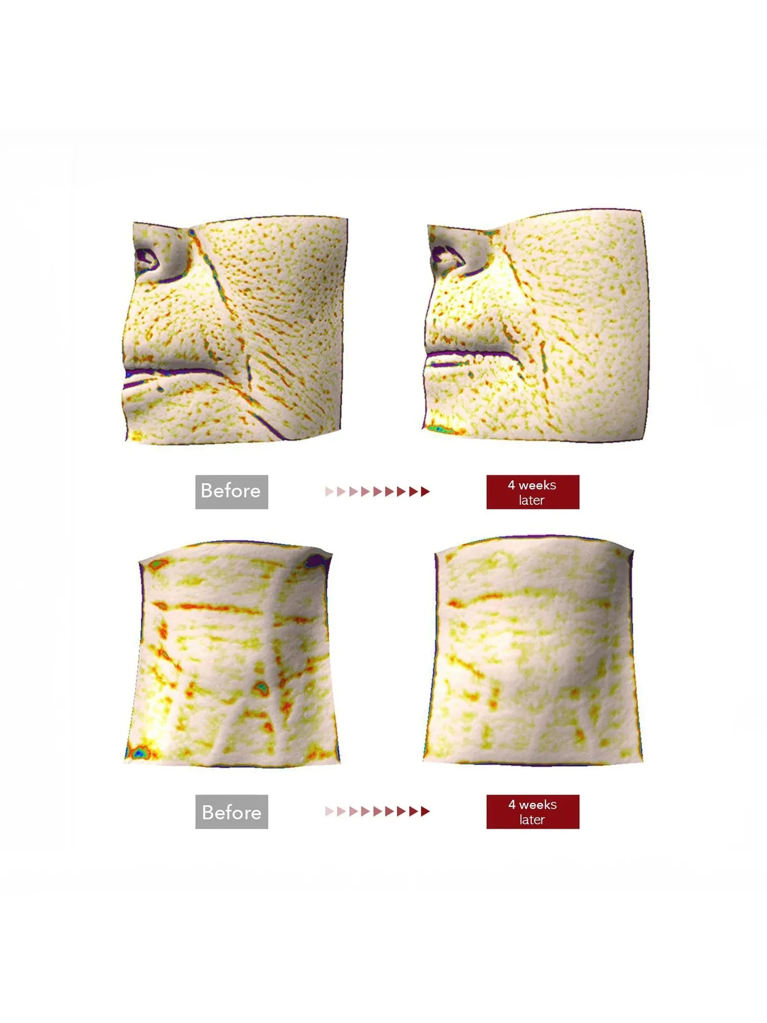 Centellian24 Madeca Cream Time Reverse - Song of Skin