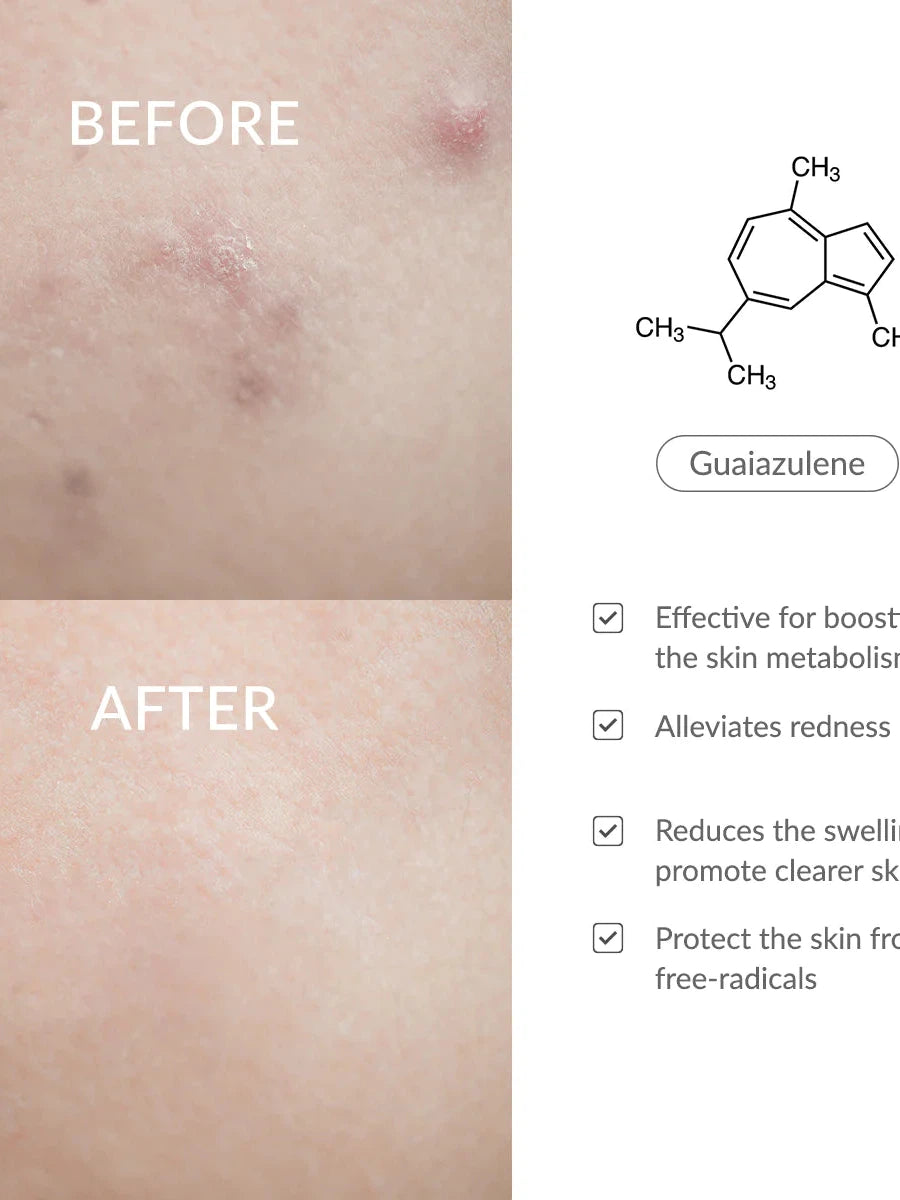 Dr. Althea Azulene 147HA Intensive Soothing Cream - Song of Skin