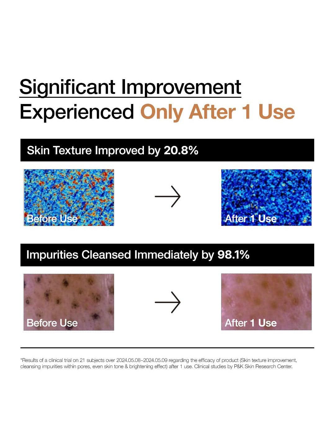 Anua Rice Enzyme Brightening Cleansing Powder - Song of Skin