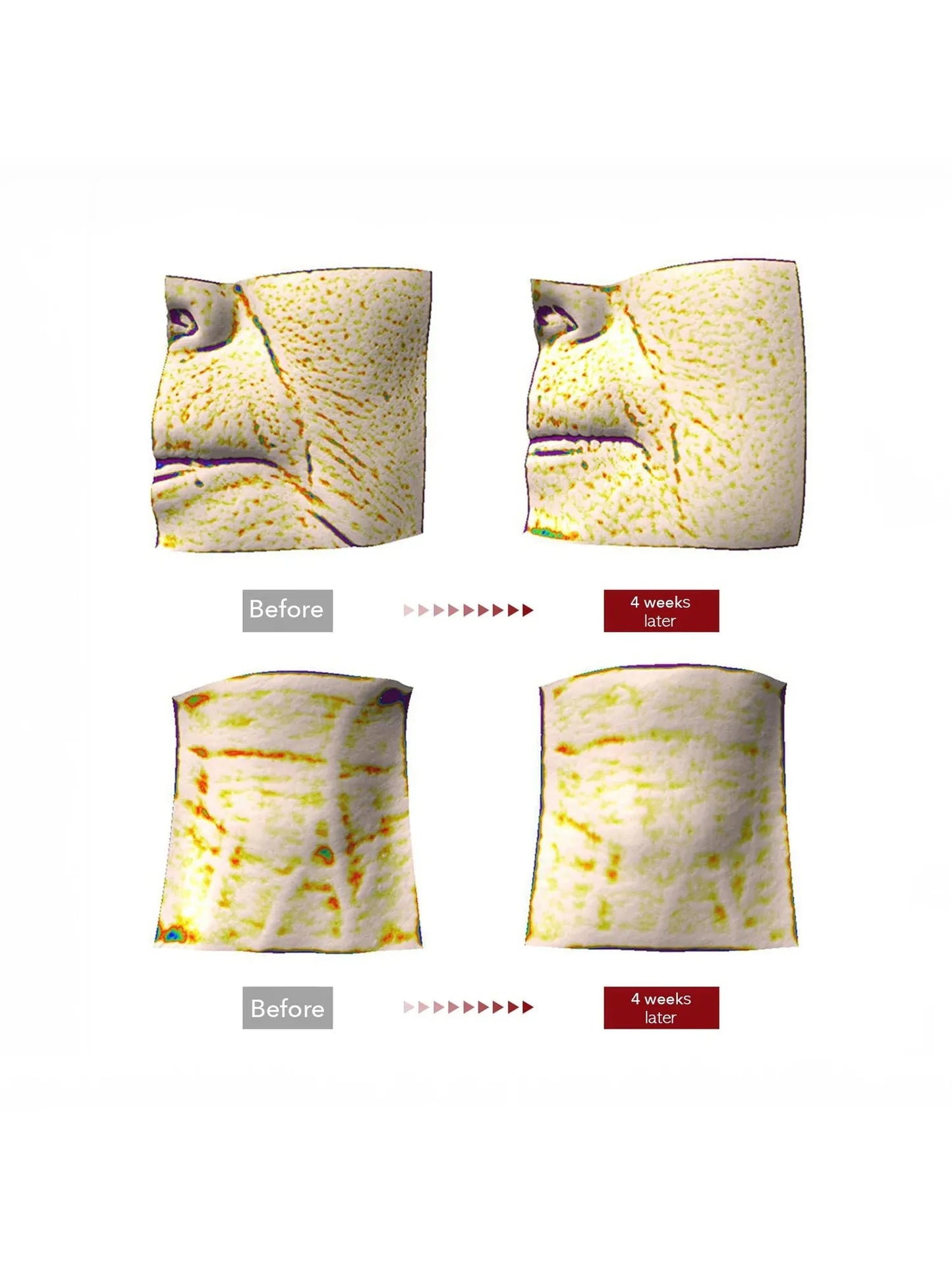 Centellian24 Madeca Cream Time Reverse