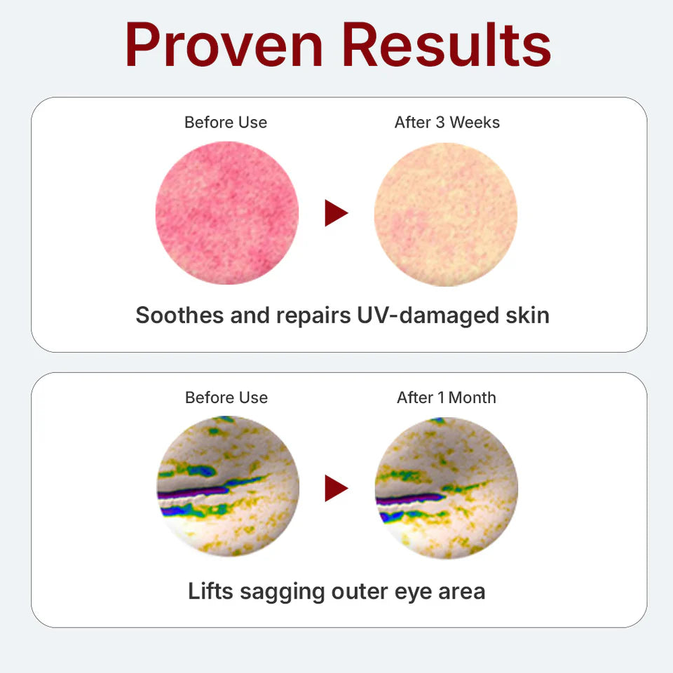 Centellian24 Madeca derma mask Ill Intensive Formula