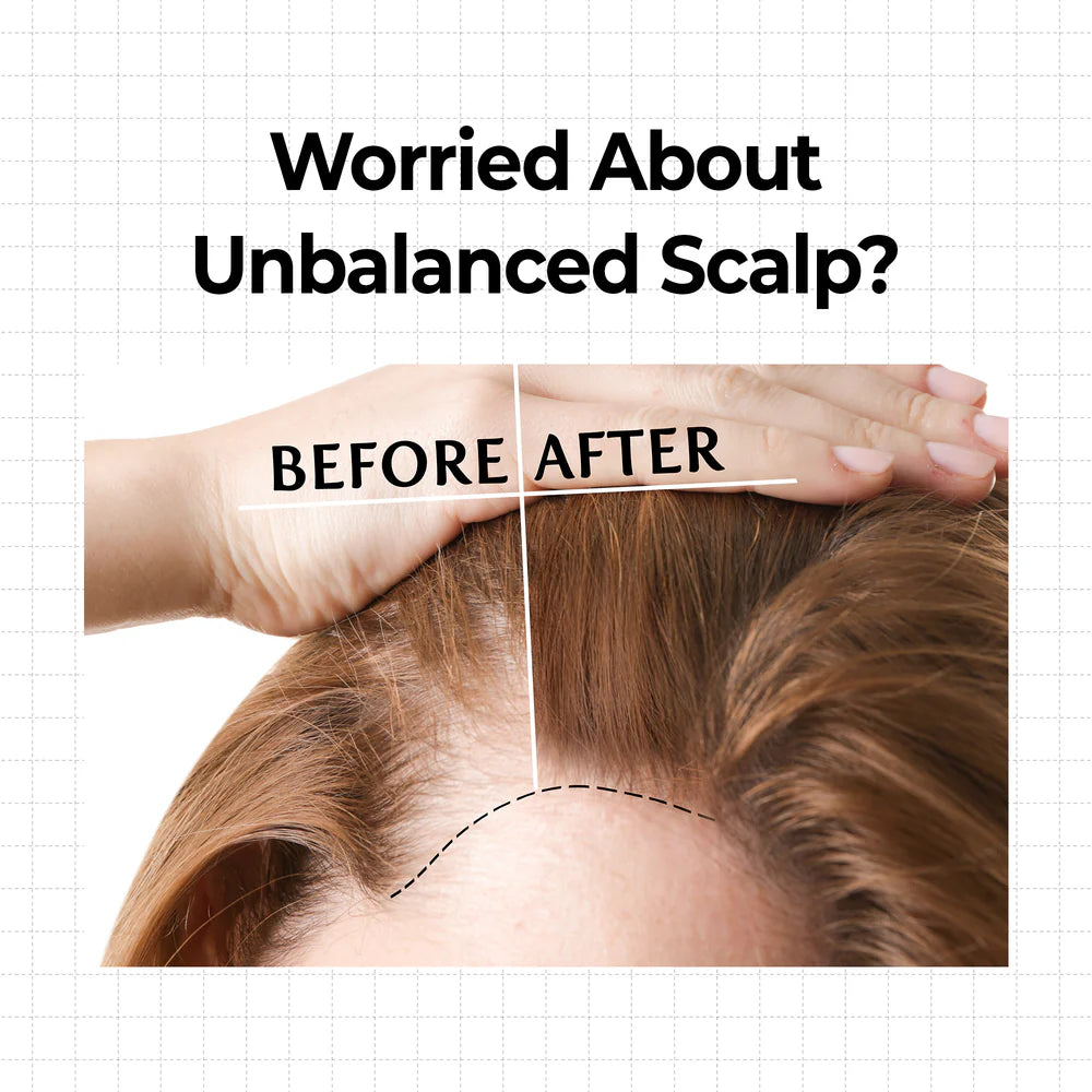 KUNDAL 10X Caffeine Strengthening Scalp Serum