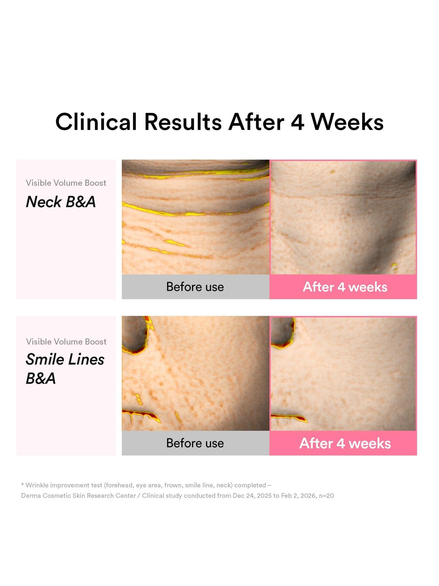 Abib PDRN Volume fill-it Booster crème 2.5 tube