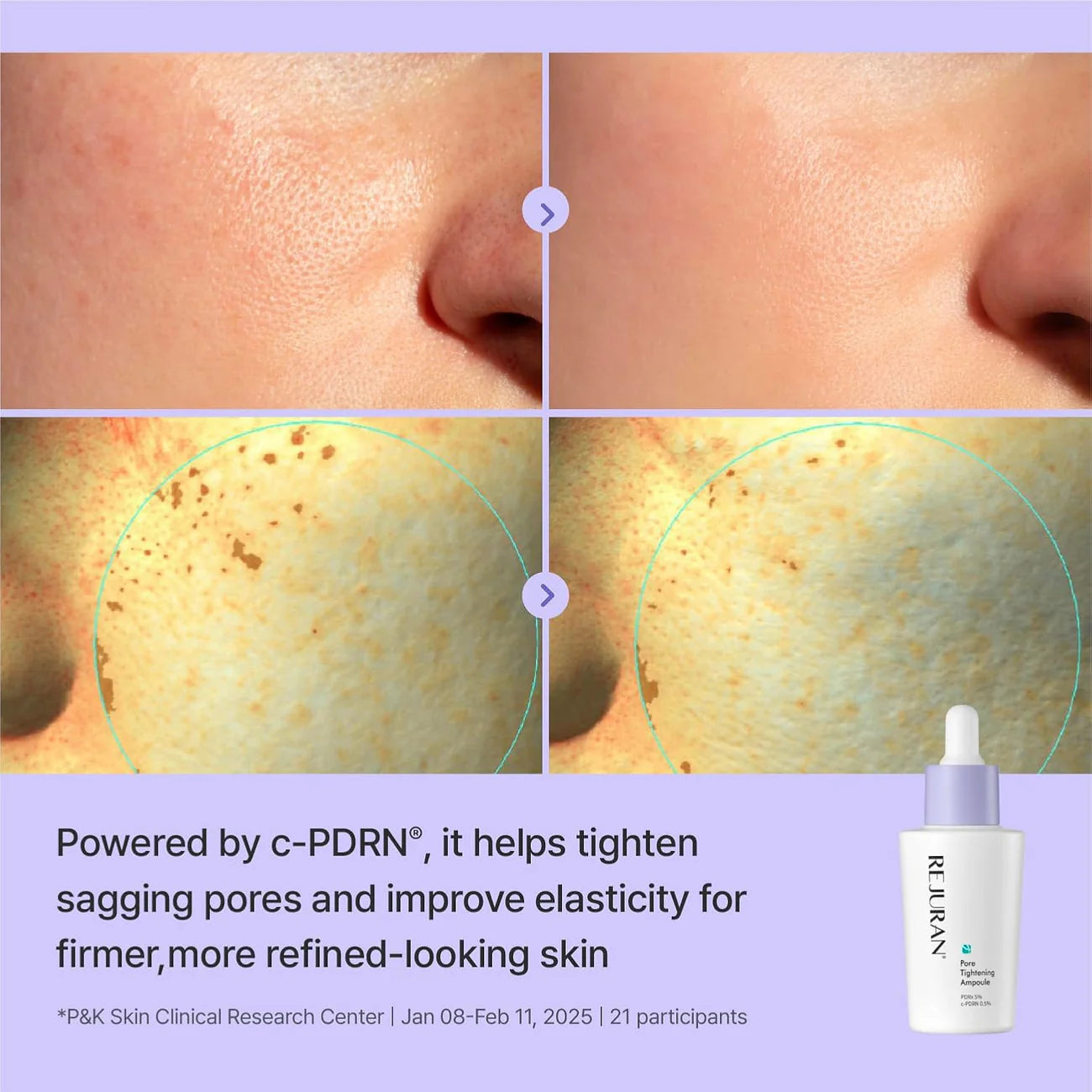 REJURAN Pore Tightening Ampoule
