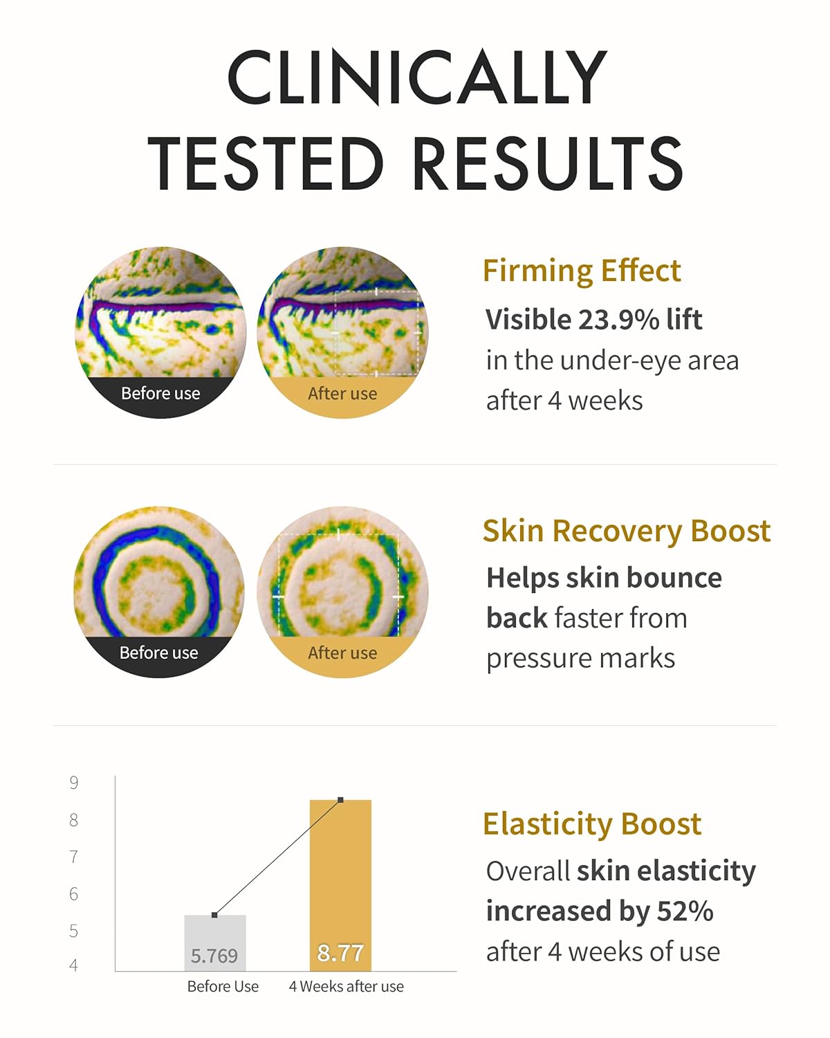REJURAN Turnover Active Cream Enhanced