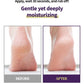 JULIOLY Foot Callus Remover Home Care Set
