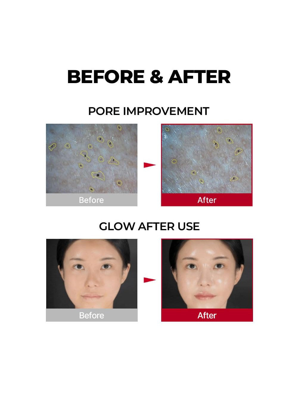 MEDI-PEEL Red Lacto Collagen Wrapping Mask | Song of Skin