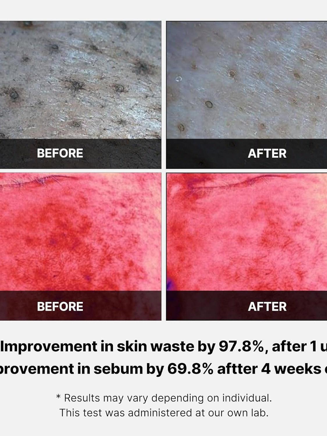 Medicube Red Succinic Acid Panthenol Pad - Song of Skin