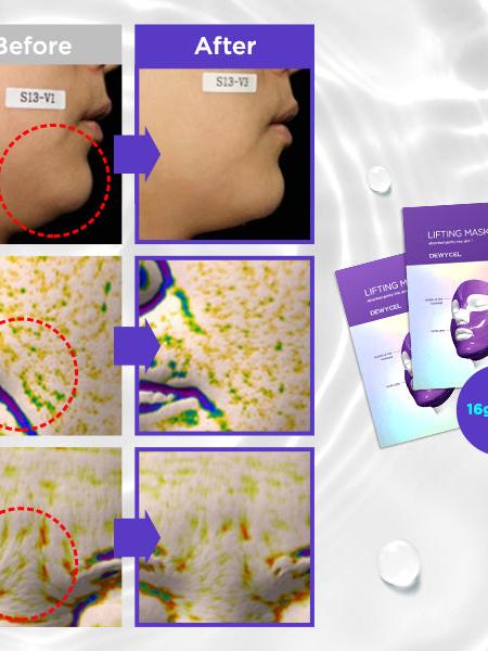 **BLACK FRIDAY DEAL** DEWYCEL Lifting Mask - Song of Skin