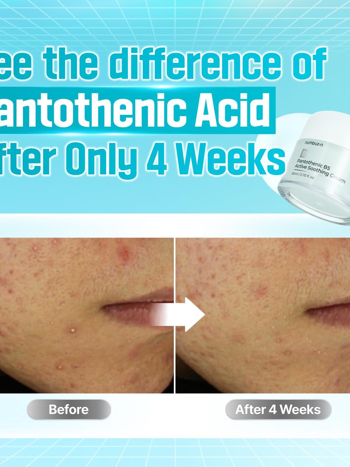 **BLACK FRIDAY DEAL** Numbuzin No.1 Pantothenic B5 Active Soothing Cream - Song of Skin