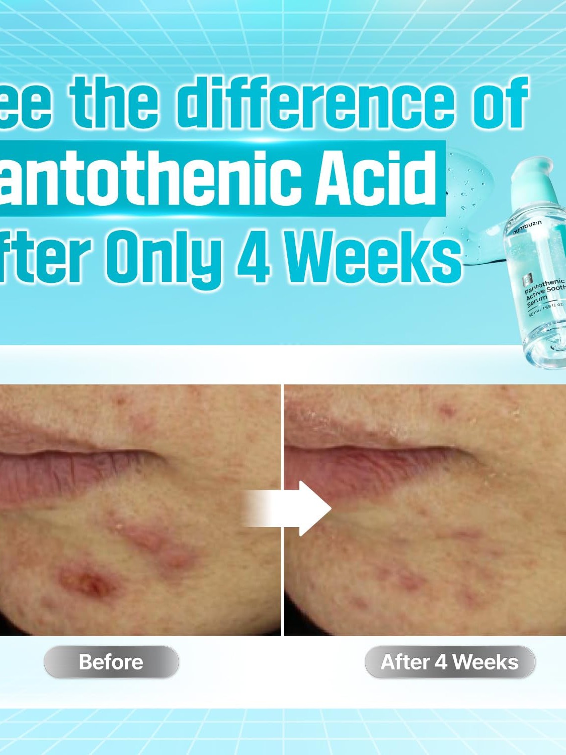 **BLACK FRIDAY DEAL** Numbuzin No.1 Pantothenic B5 Active Soothing Serum - Song of Skin