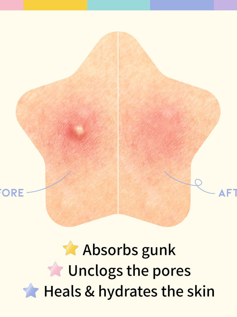 OOTD BEAUTY Star Spot Patch - 80 patches - Song of Skin