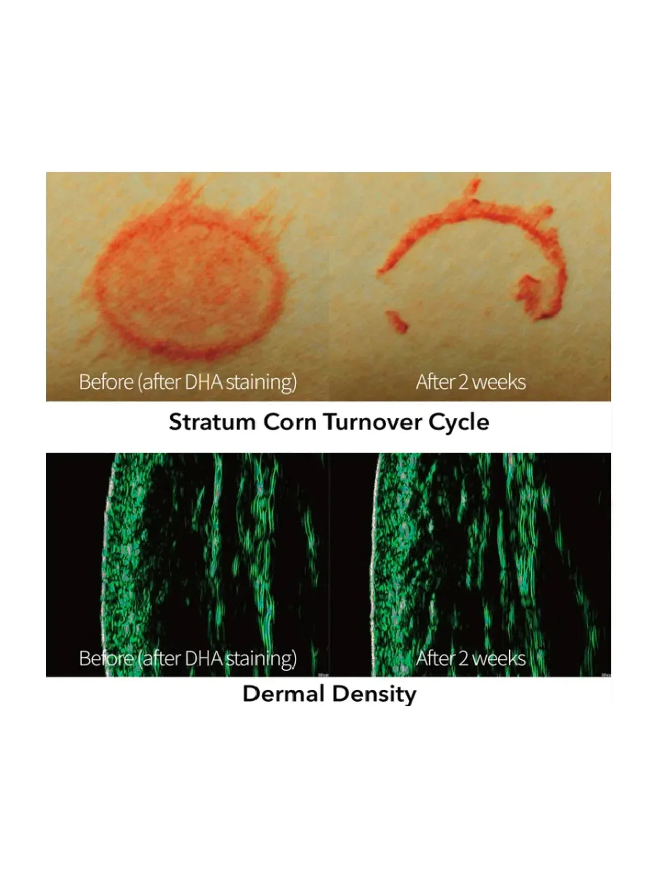 REJURAN Turnover Ampoule 30ml - Song of Skin