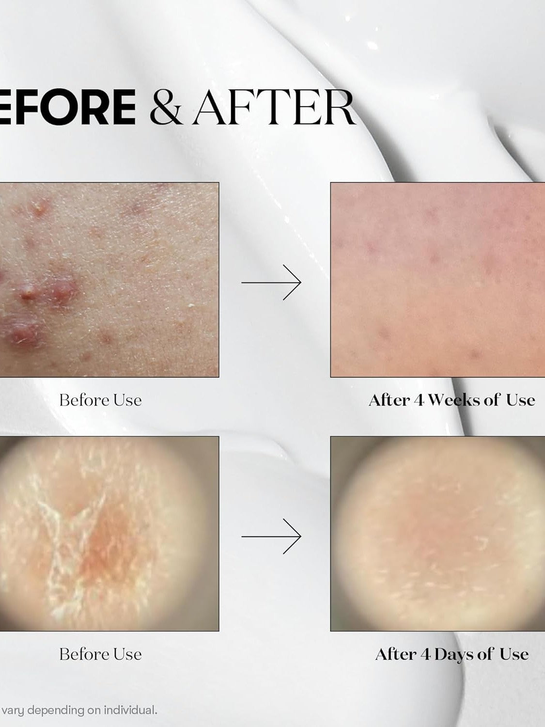 VT Cica Reedle Shot 100 - Song of Skin