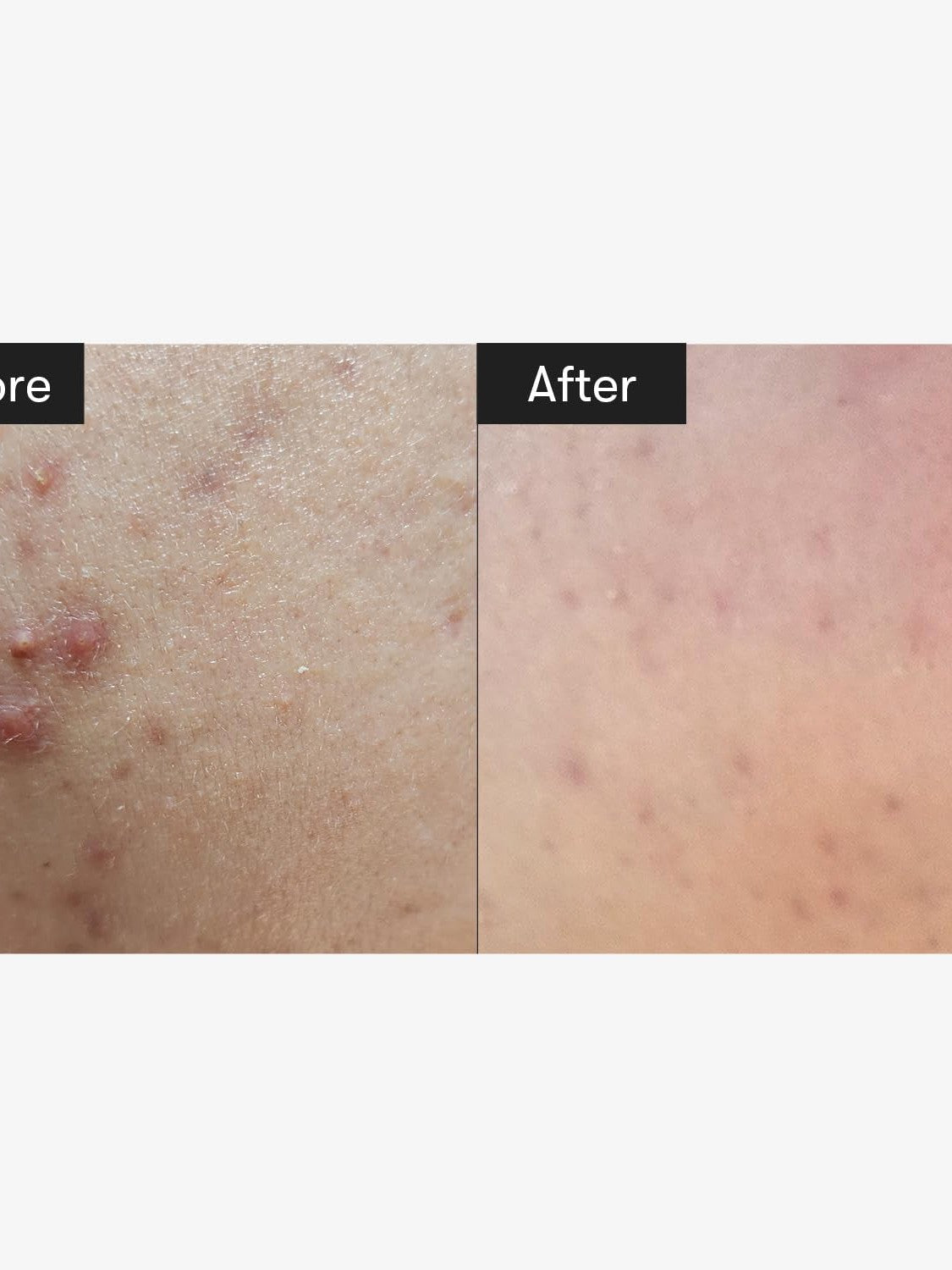 VT Cica Reedle Shot 300 - Song of Skin