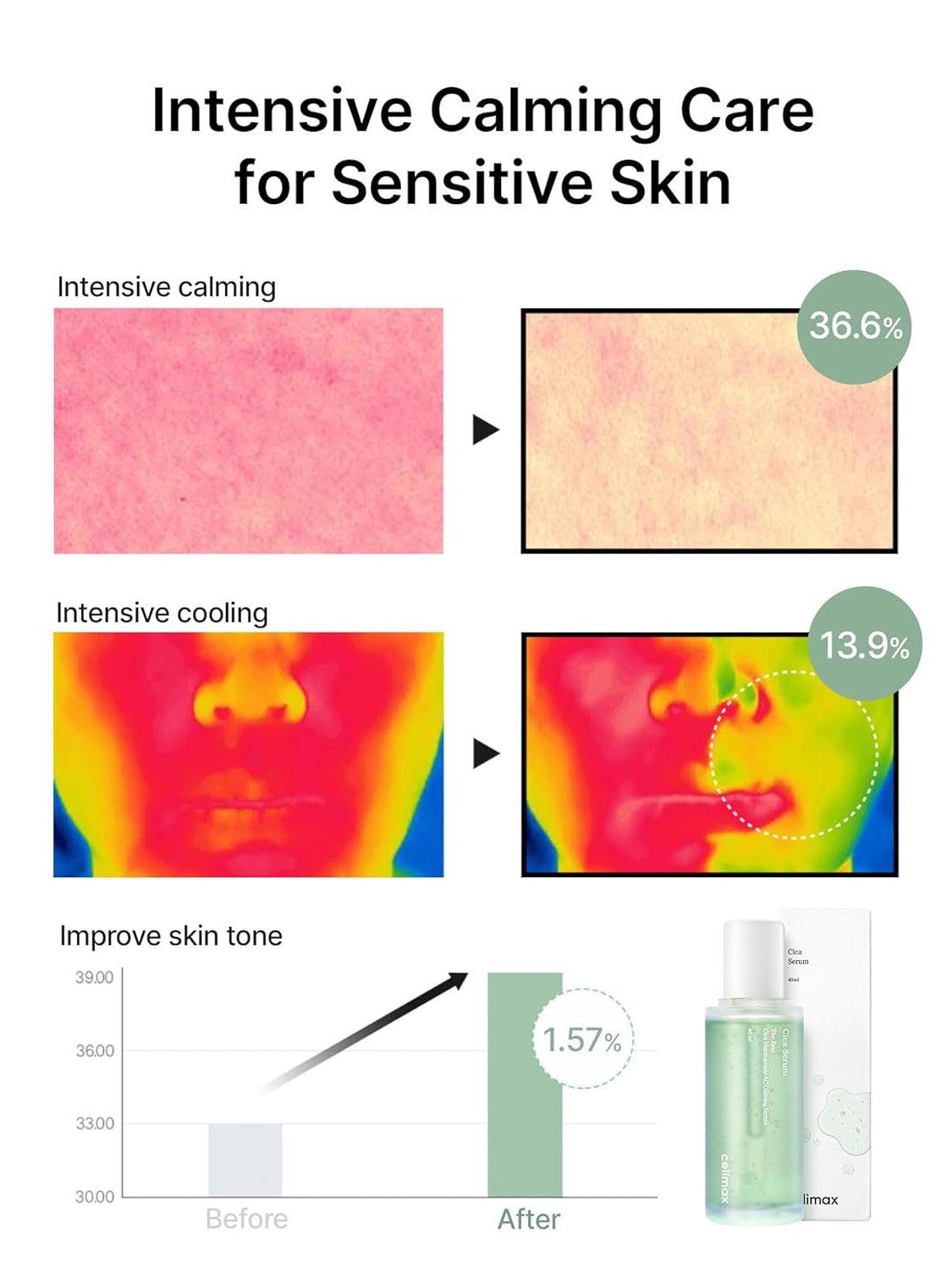 celimax The Real Cica Niacinamide AC Calming Serum - Song of Skin