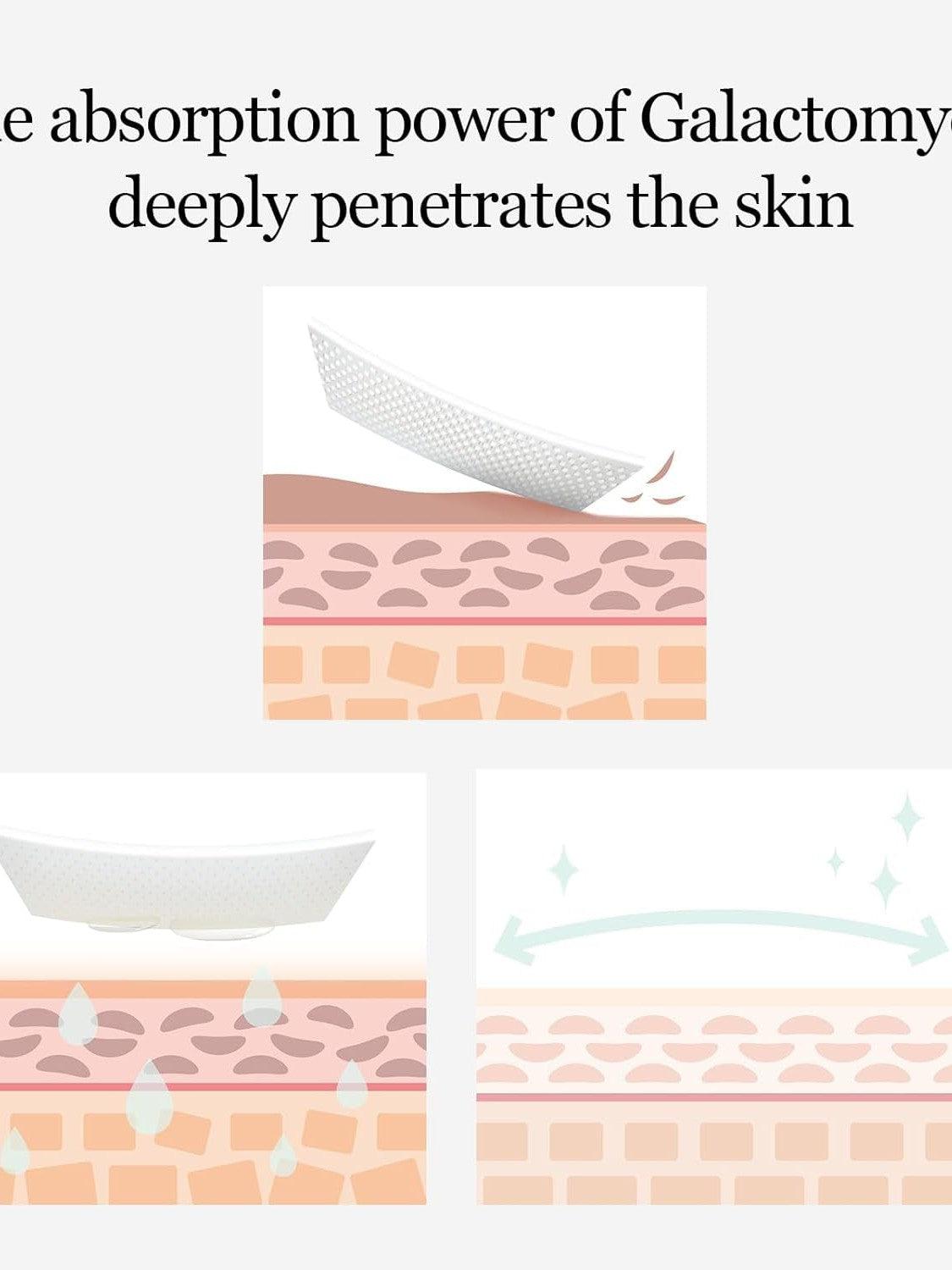 mixsoon Galactomyces Toner Pad - Song of Skin